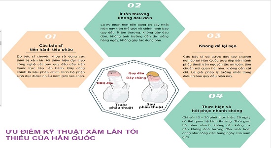 Ưu điểm cắt bao quy đầu kiểu hàn quốc
