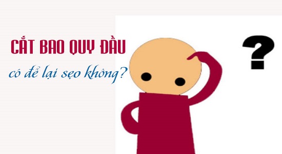 Cắt bao quy đầu có để lại sẹo không