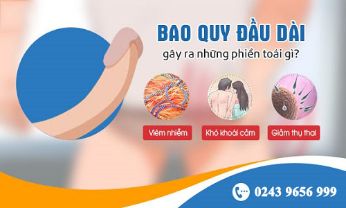Dài bao quy đầu giả