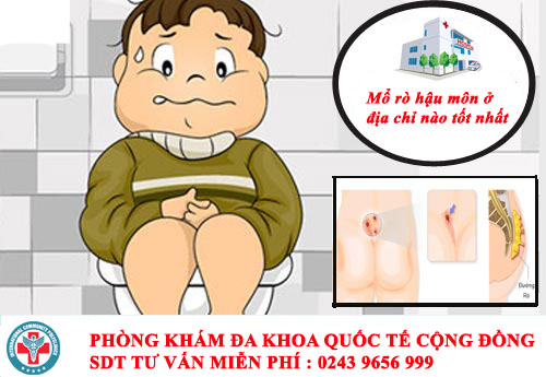 Mổ rò hậu môn ở đâu tốt