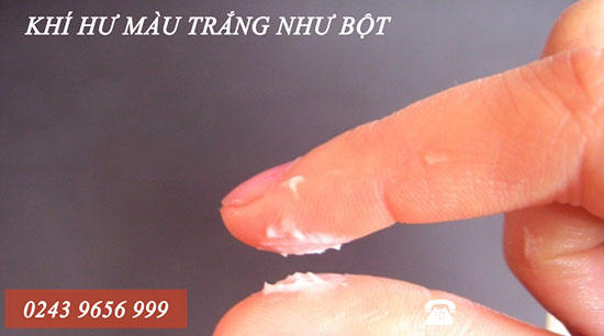 Khí hư màu trắng như bột