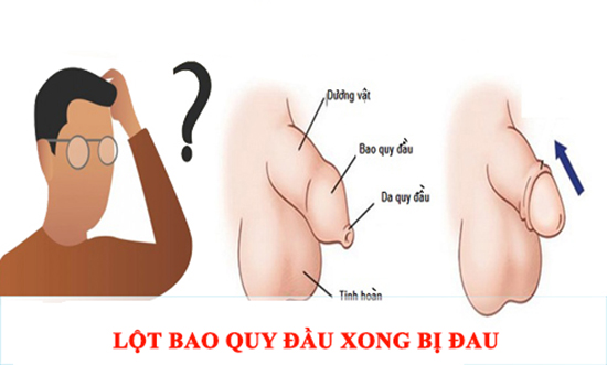 Lột bao quy đầu xong bị đau