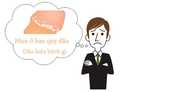 Mụn ở bao quy đầu là bệnh gì