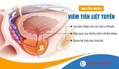 Viêm tuyến tiền liệt