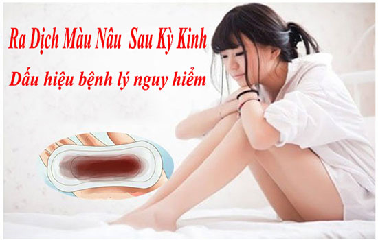 Ra dịch màu nâu sau kỳ kinh là bệnh gì