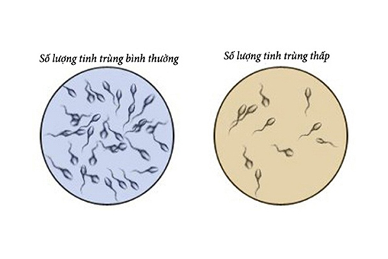 Tinh dịch ít