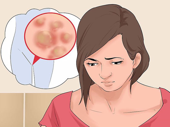 Triệu chứng sùi mào gà nữ