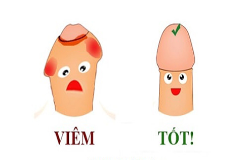Bệnh viêm bao quy đầu có nguy hiểm không