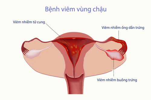 Vùng chậu là vùng nào