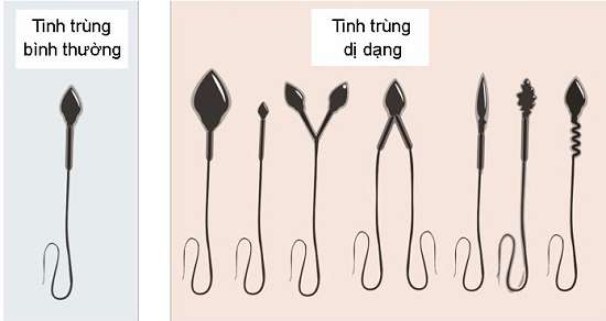 Xét nghiệm tinh dịch đồ ở đâu hà nội uy tín